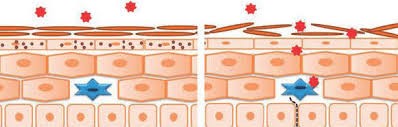 Debilitación de la barrera de la piel por falta de filagrina