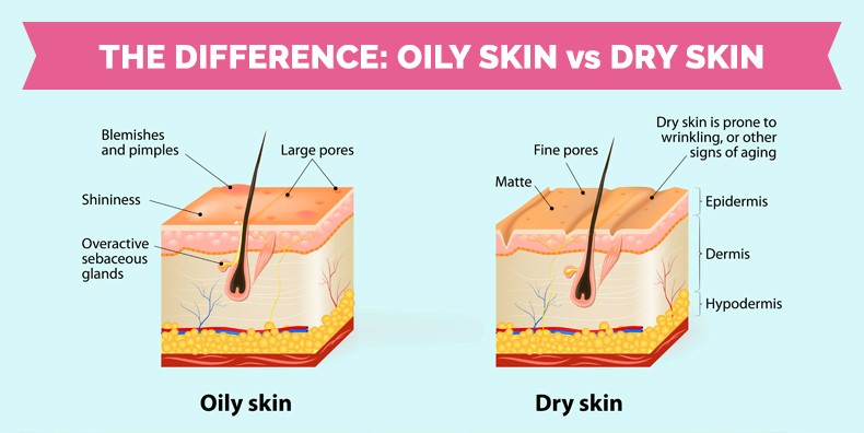 Diferencias entre piel seca y piel grasa