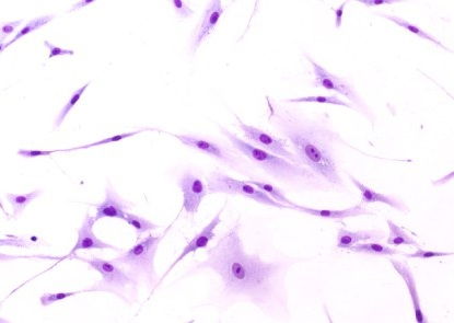 Fibroblastos productores de colágeno