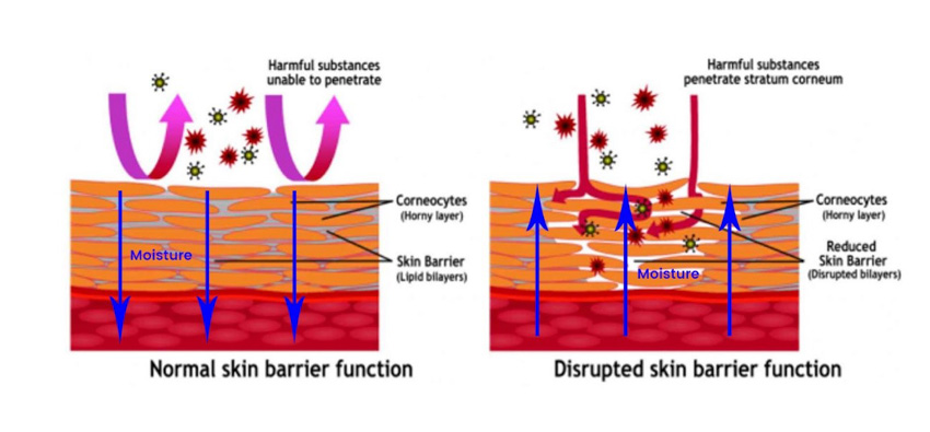 Comparación de la función barrera natural de la piel y una barrera deteriorada