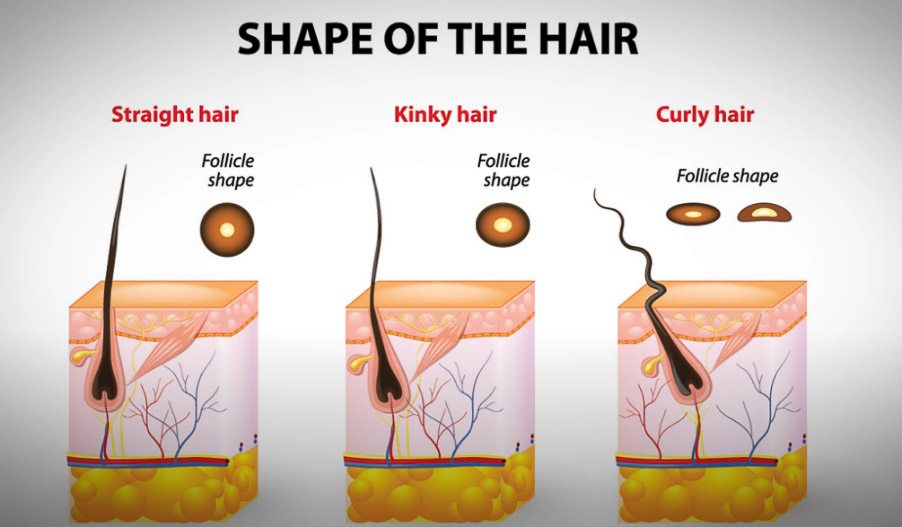 Cómo penetra el cabello rizado en el cuero cabelludo